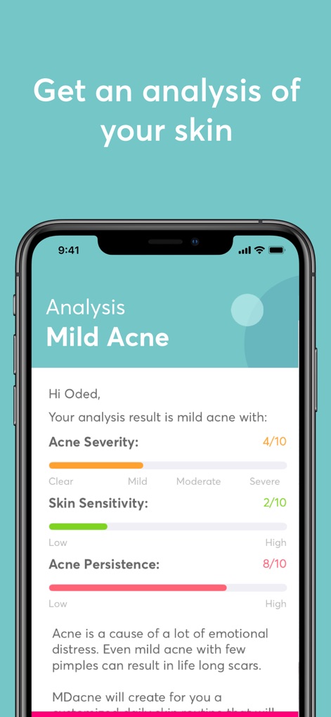 MDacne - Custom Acne Treatment - Users receive a comprehensive skin analysis, detailing their "Acne Severity" and "Skin Sensitivity" to inform their custom treatment plan.