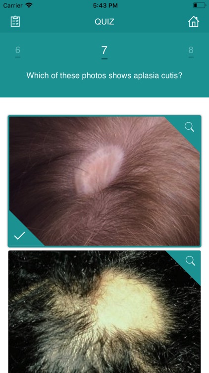 DermSwipe screenshot-3