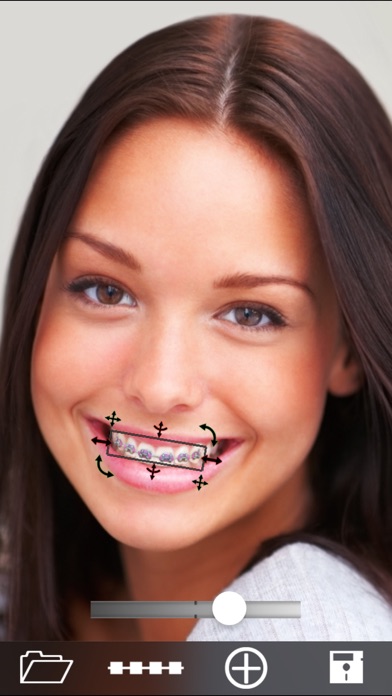 歯列矯正装置を付けよう (Brace Face)のおすすめ画像2