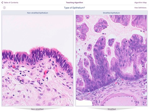 Ovarian Tumor Pathologyのおすすめ画像4