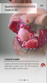 3D ECG Leads screenshot