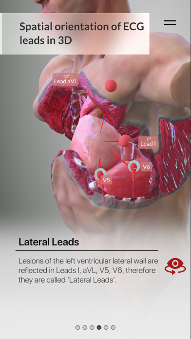 3D ECG Leads Screenshot