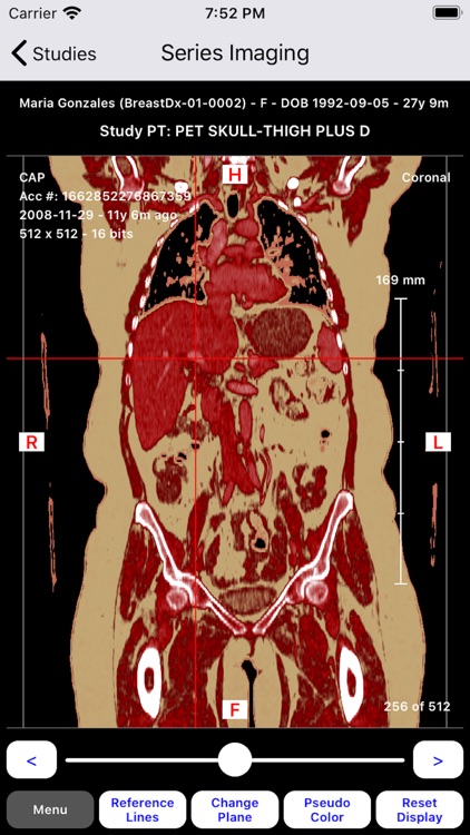 RAD Explorer screenshot-8