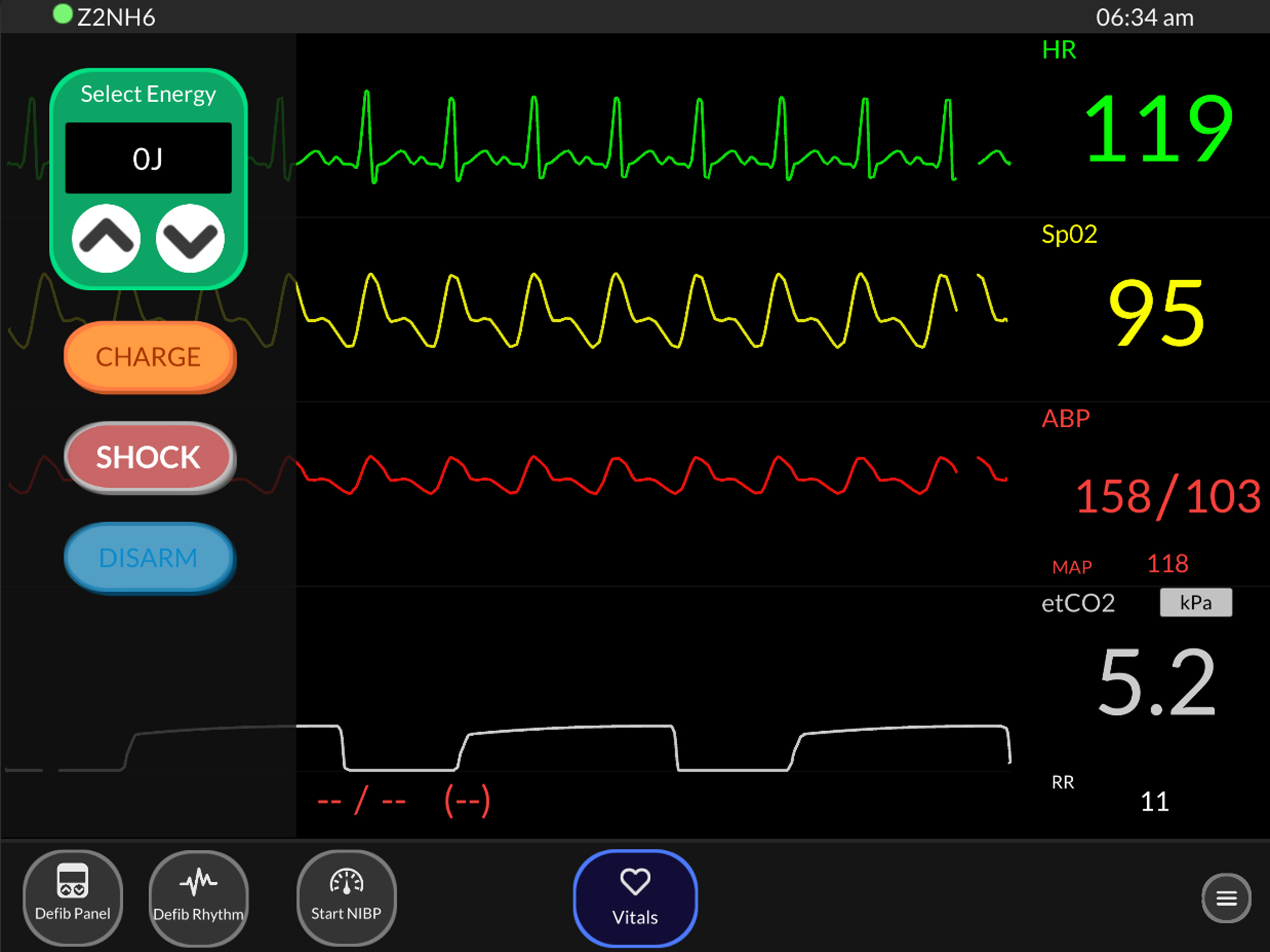 Simpl Patient Monitor screenshot 5