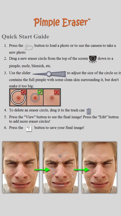 Pimple Eraser screenshot 5