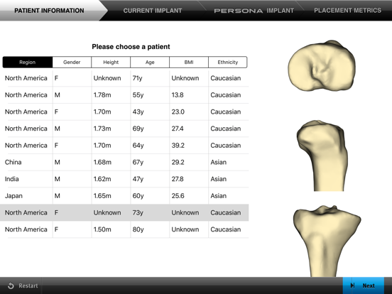 Screenshot #4 pour Persona® TKA Tibial Placement