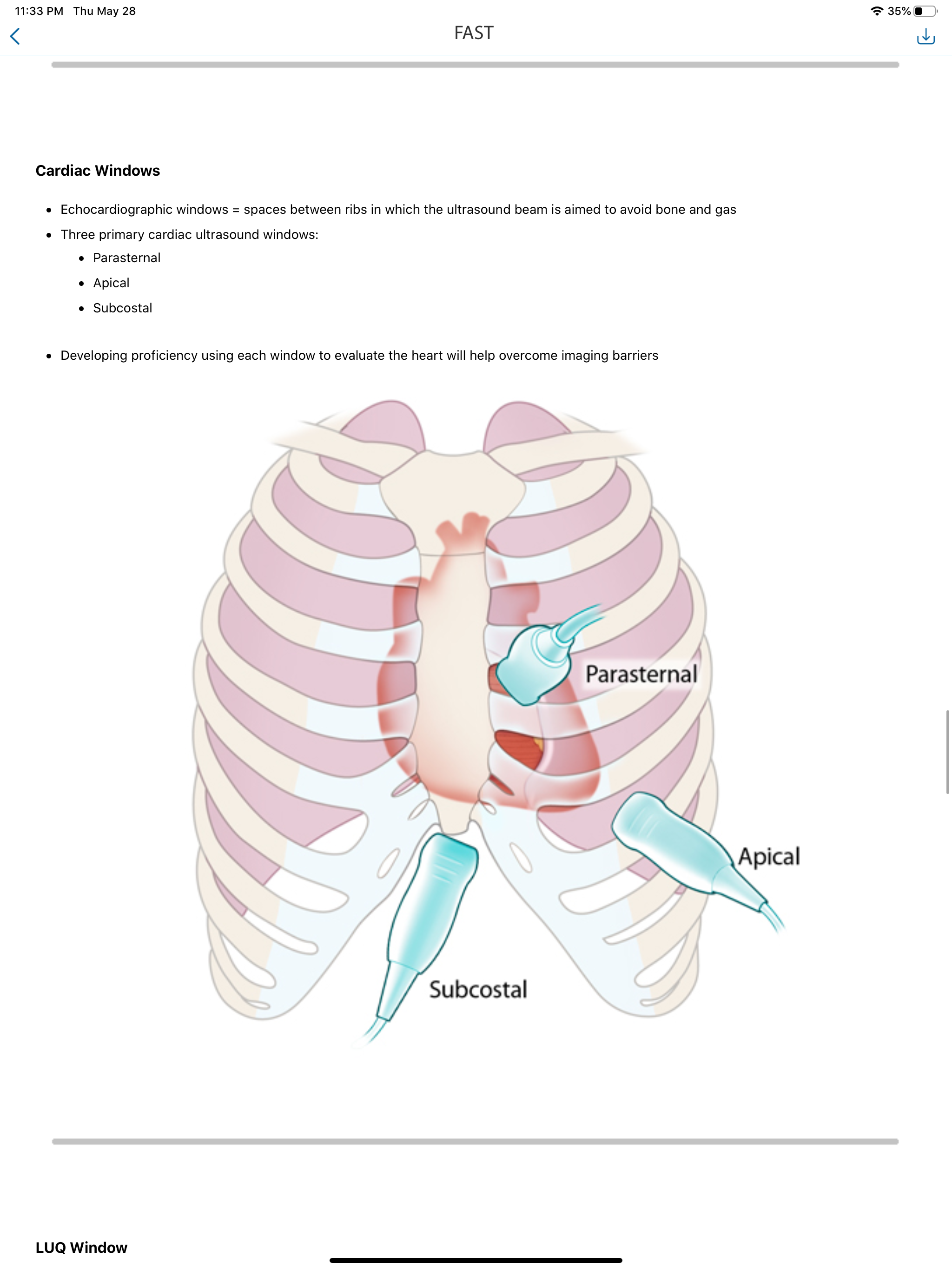 SonoSim