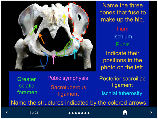 MSK Anatomy - SecondLook iPad screenshot 5 - Medical app