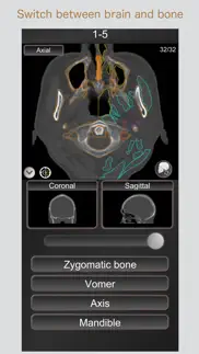 ct passquiz head/brain / mri problems & solutions and troubleshooting guide - 1