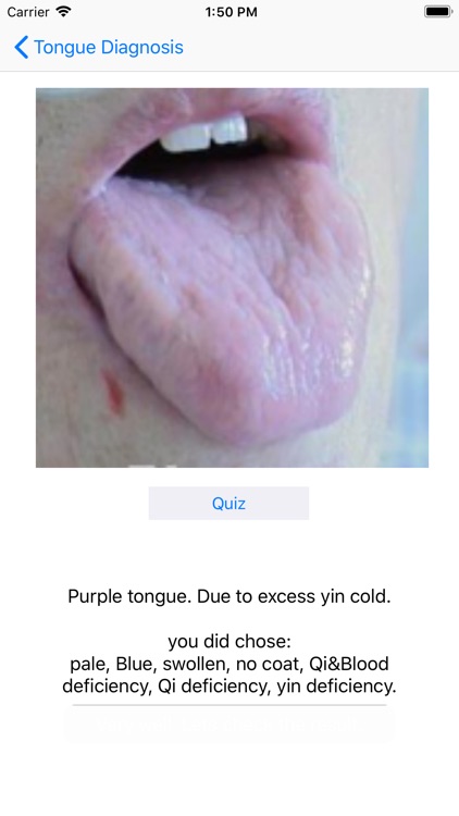 Tongue Diagnosis screenshot-4