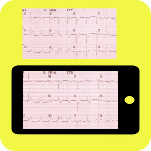 ECG Reader iOS App