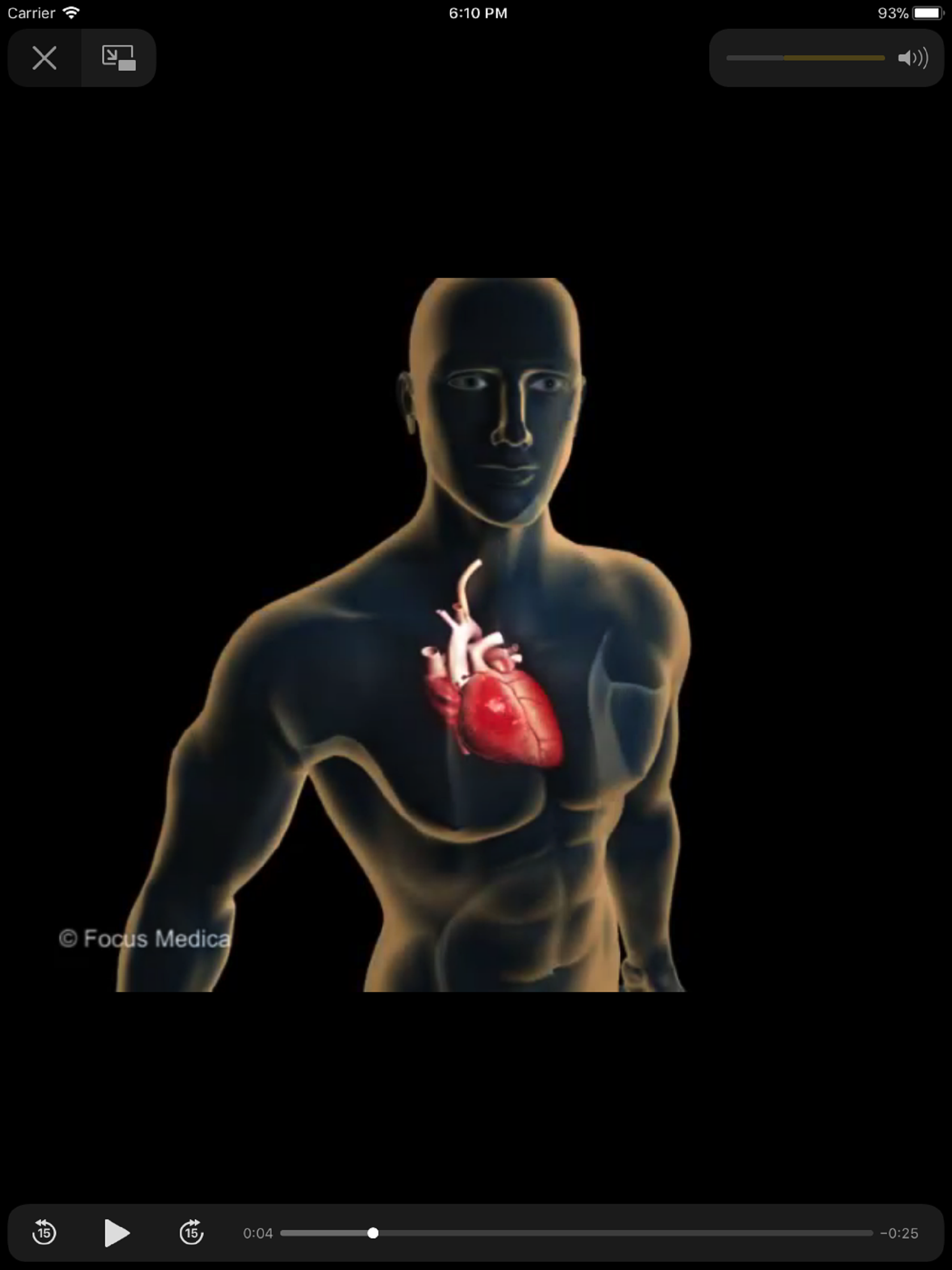 Cardiology Dictionary screenshot 9