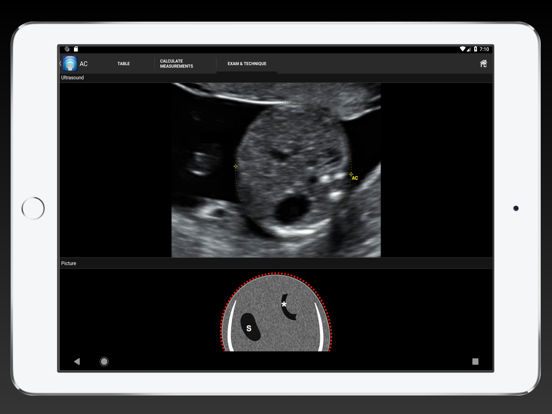 MedUltra iPad screenshot 3 - Medical app