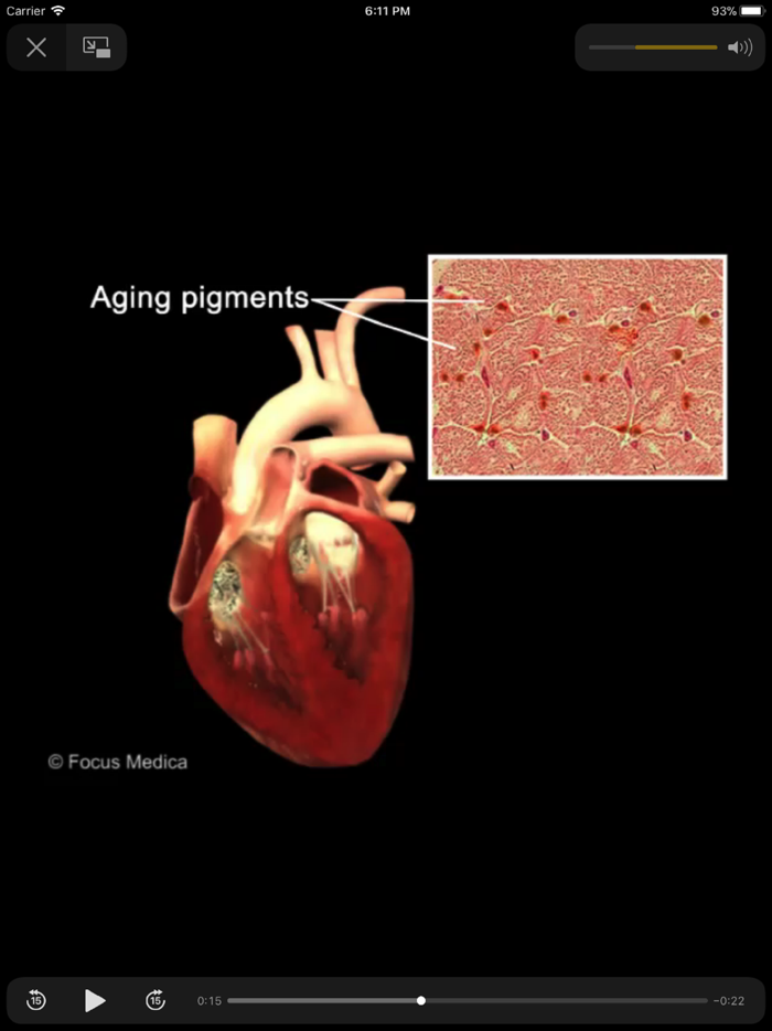 Cardiology Dictionary