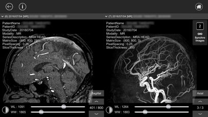 DICOM Viewer : eMmaのおすすめ画像4