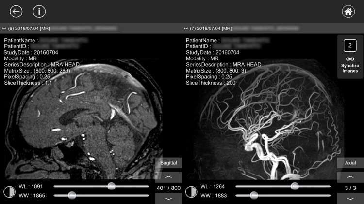 DICOM Viewer : eMma screenshot-3