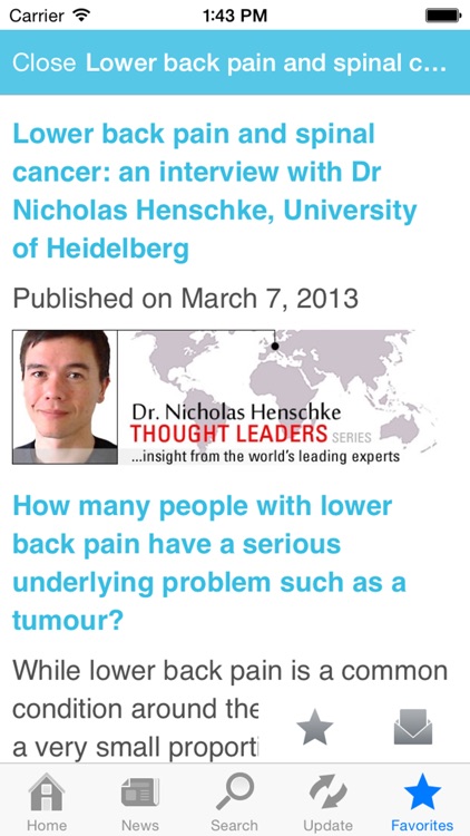 Back Pain by AZoMedical