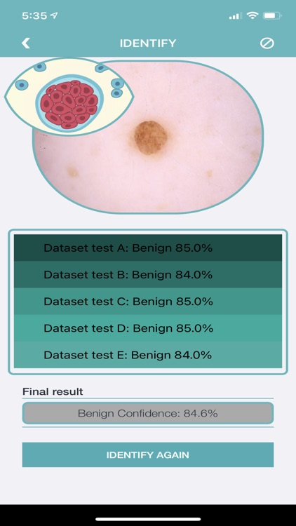 Skin Checker For Your Mole screenshot-7