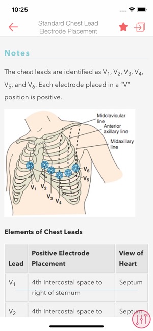 ECG Notes: Quick look-up ref.(圖3)-速報App