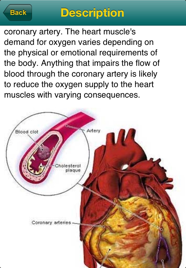 Medical Encyclopaedia Lite screenshot 4