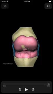 How to cancel & delete rheumatology dictionary 2