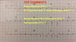 ecg reader problems & solutions and troubleshooting guide - 1