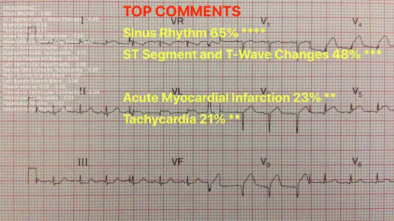 ECG Reader screenshot 3 of 3