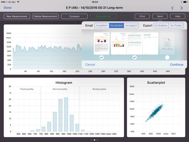 ANS Analysis screenshot-6