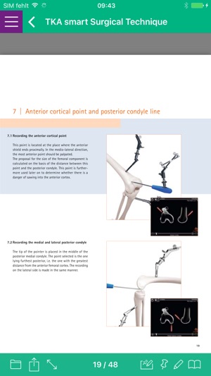 AESCULAP® OrthoPilot®(圖3)-速報App