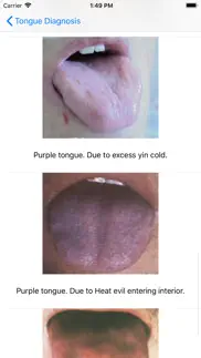 tongue diagnosis iphone screenshot 4