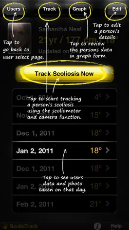 Game screenshot ScolioTrack apk