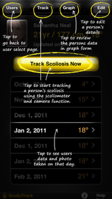 ScolioTrack screenshot