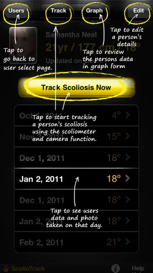ScolioTrack iPhone Ekran Görüntüsü 2