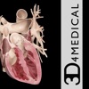 3D4Medical Body Systems for iPhone