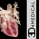 Heart Pro III - iPhone App Cancel