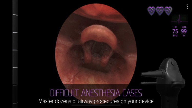 Airway Ex screenshot-0