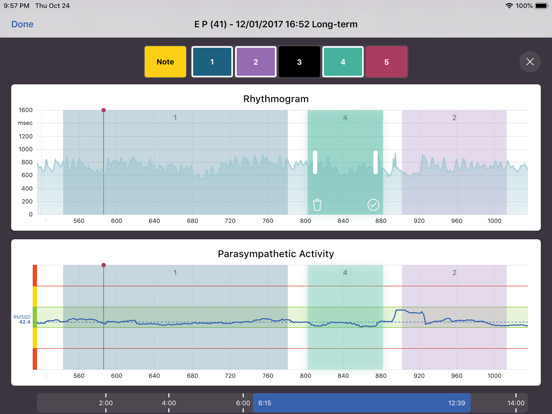 ANS Analysis iPad screenshot 3 - Medical app