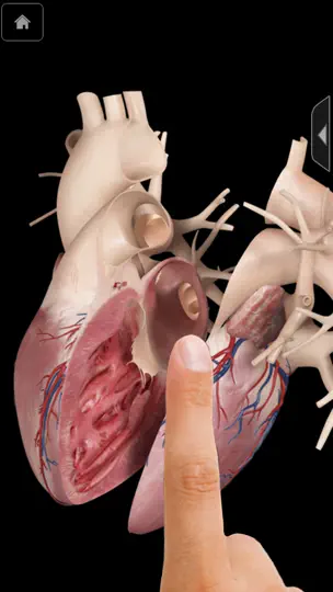 Heart Pro III - IPhone iPhone Screenshot 1