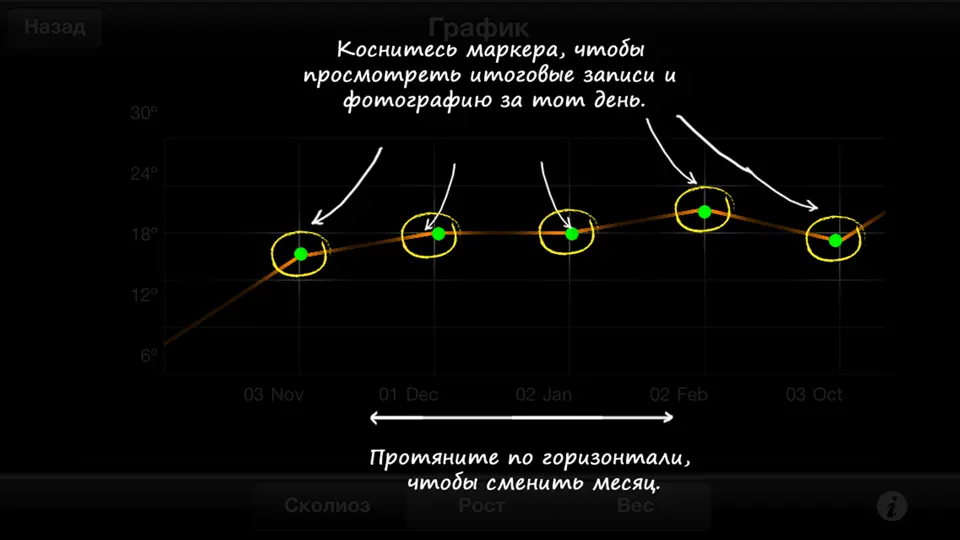 Скриншот Сколиоз Инспектор на iPhone 10