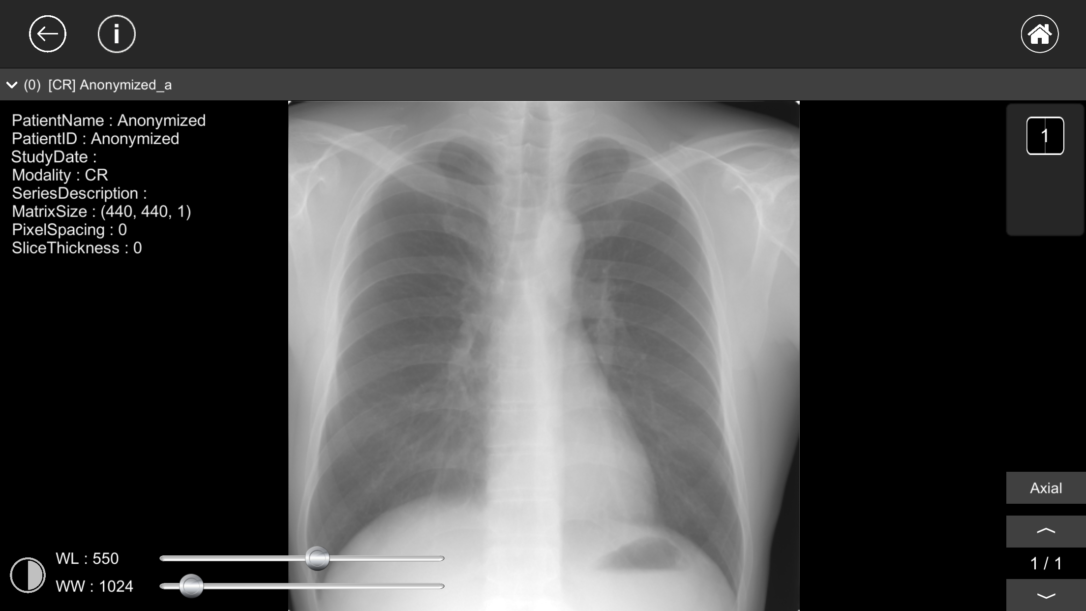 DICOM Viewer : eMma
