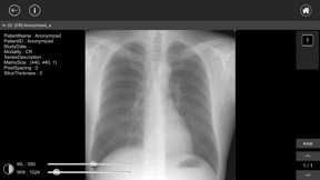 DICOM Viewer : eMma screenshot