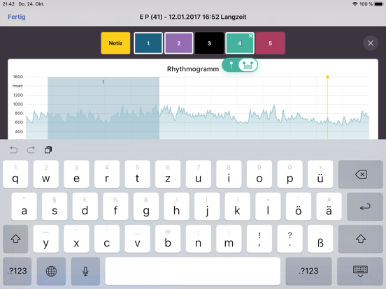 Screenshot #6 pour VNS Analyse