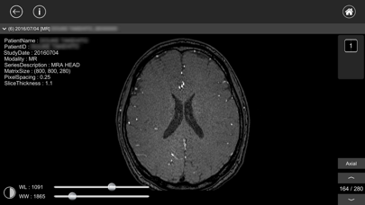 DICOM Viewer : eMmaのおすすめ画像2