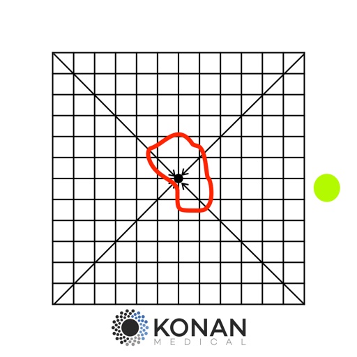 Amsler Grids