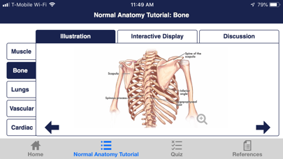 CTisus Chest Atlas 3D CRT screenshot 2