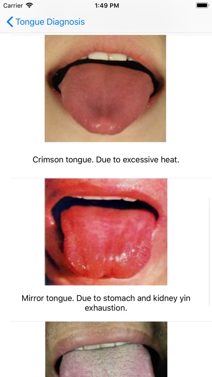 Tongue Diagnosis