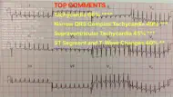 ECG Reader iphone resimleri 1