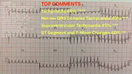 ecg reader iphone screenshot 1