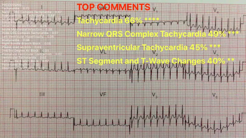 ECG Reader screenshot 1 of 3