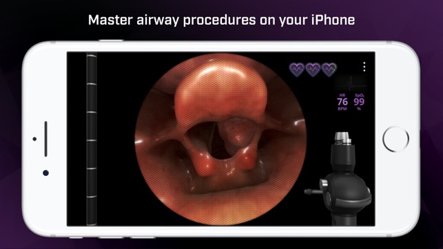 Airway Ex(圖1)-速報App